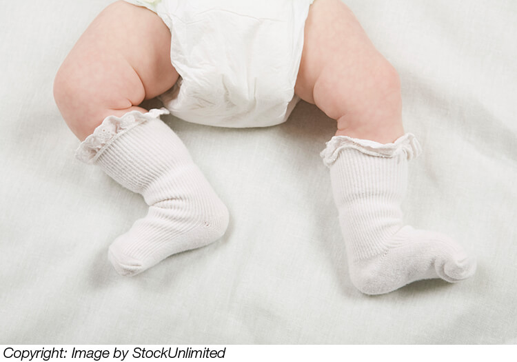 Babys wunder Po – Windeldermatitis